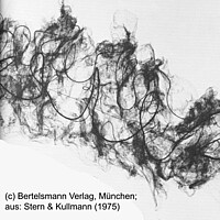 Cribellater Fangfaden mit Achsenfaden, Kräuselschlingen und der Fangwolle (Aufnahme Rasterelektronenmikroskop)